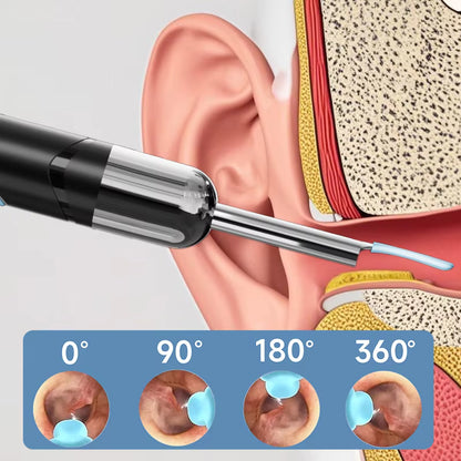 SafeEar™ Pro – Smart Ear Cleaning Made Simple